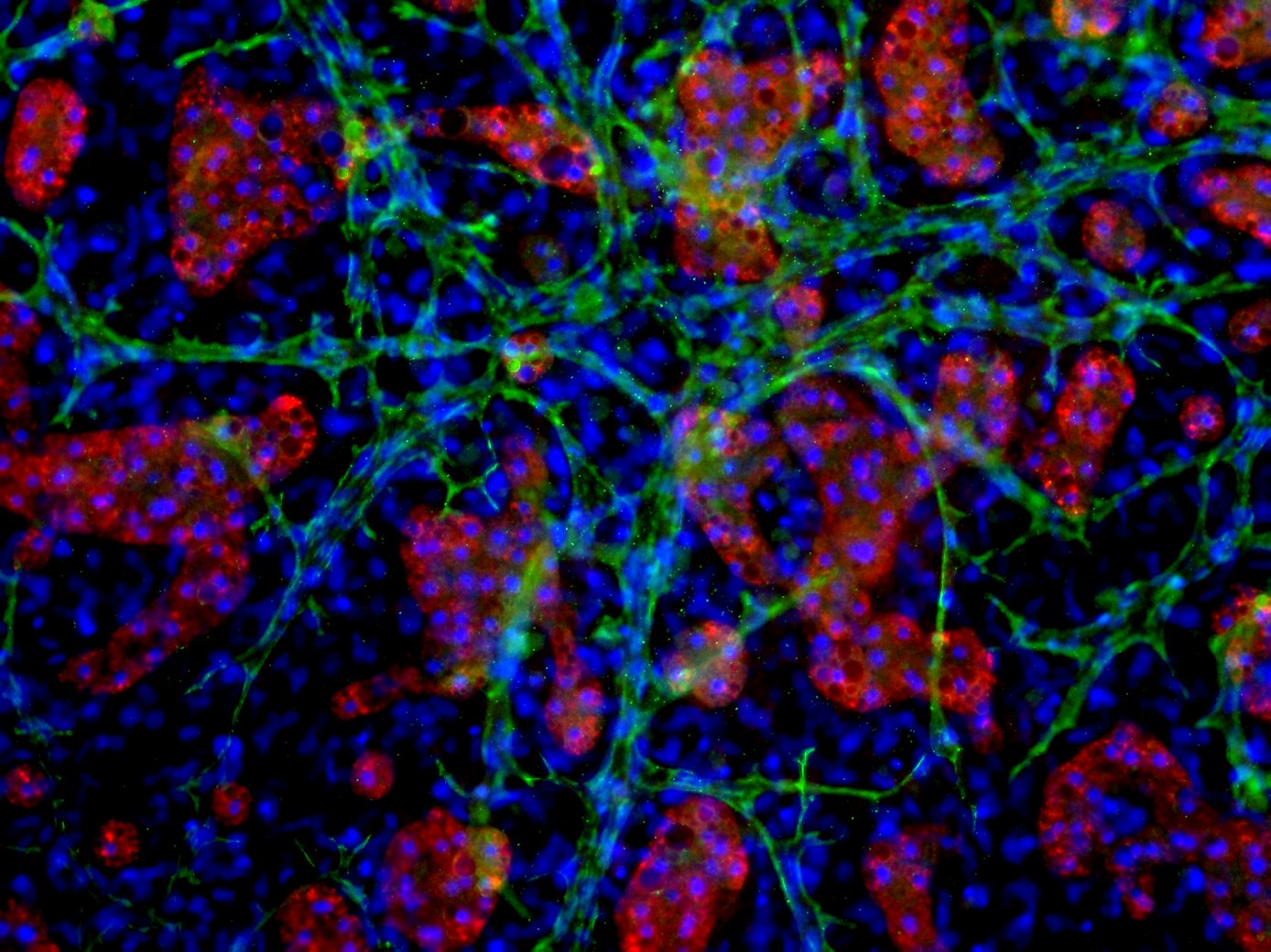 Immunofluorescent image of LifeNet Health LifeSciences all-human Hepatic Tri-Culture system at day 28 stained to show each cell type. Hepatocytes are stained in red to show albumin production, stromal cell nuceli are stained blue with DAPI, and the endothelial cells are stained for CD31 in green.