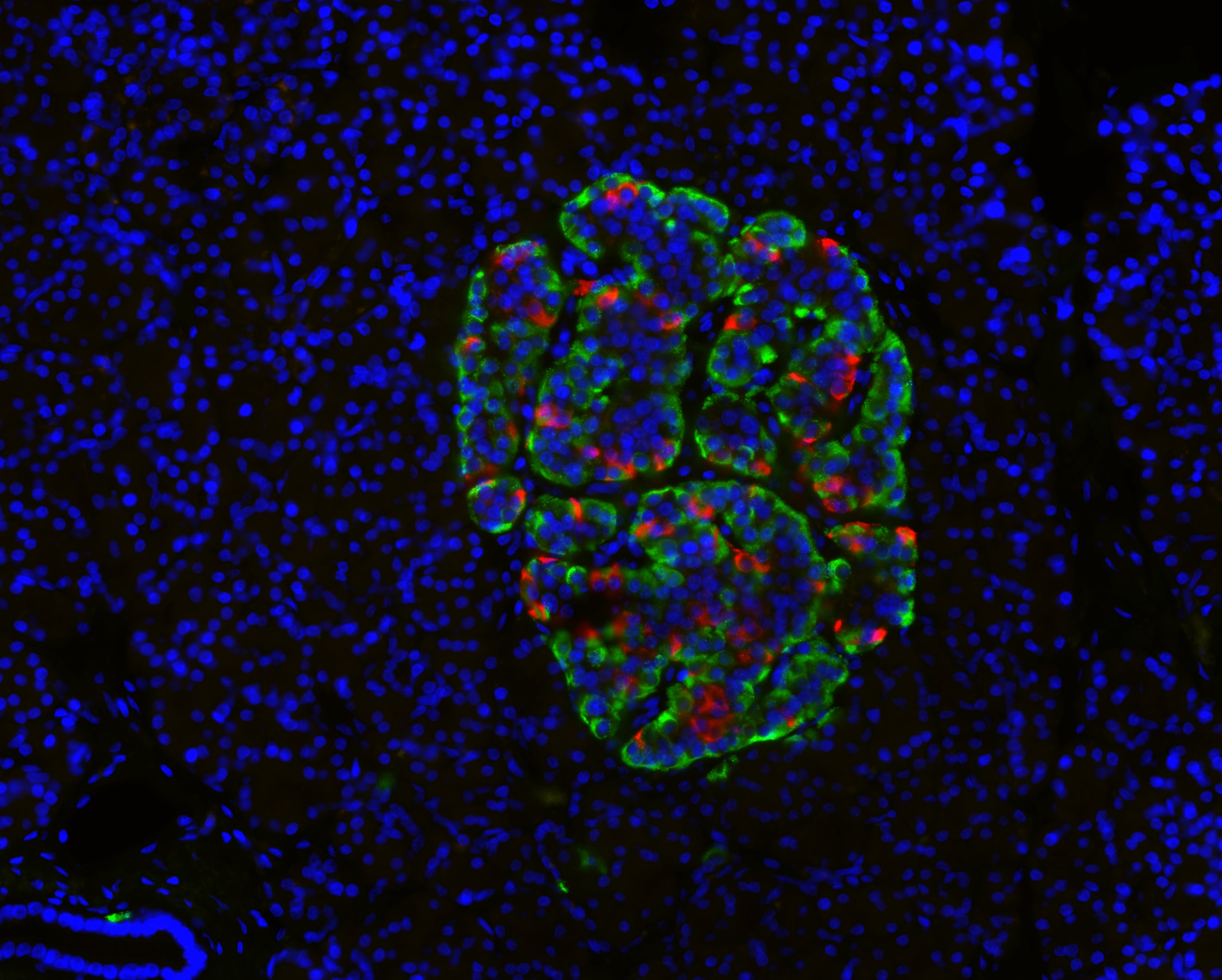 Immunohistochemical (IHC) stained human pancreatic tissue with islet