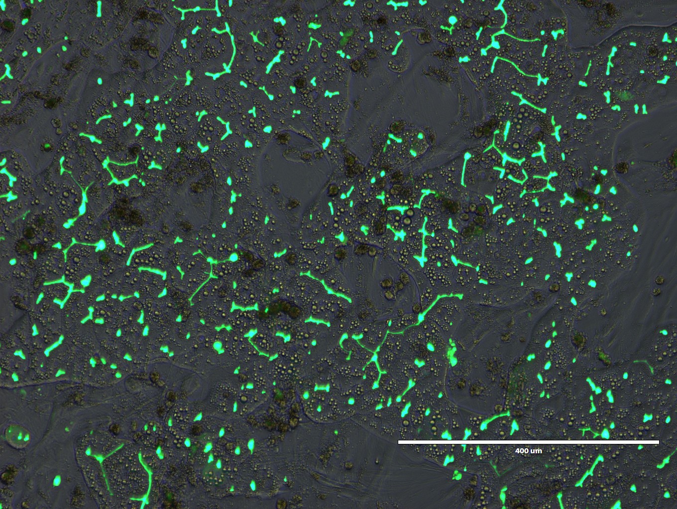 LifeNet Health LifeSciences all-human Hepatic Tri-Culture system stained to show bile canaliculi formation at 100X Magnification