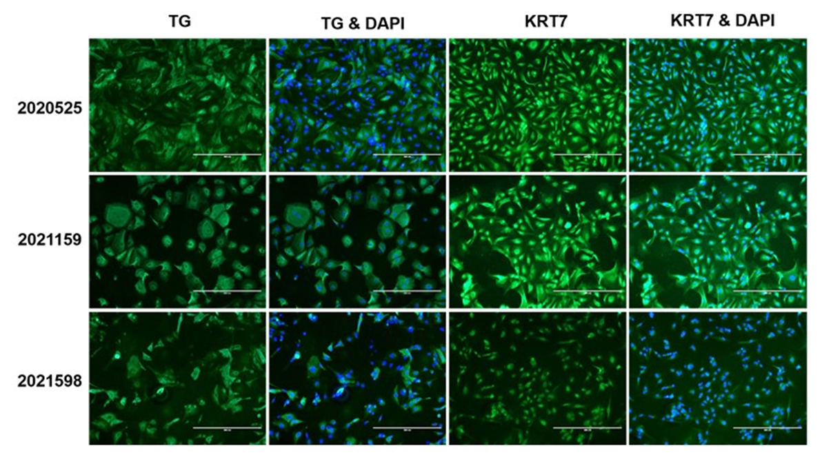 ICC of primary human thyrocyte monolayers in 96-well plates