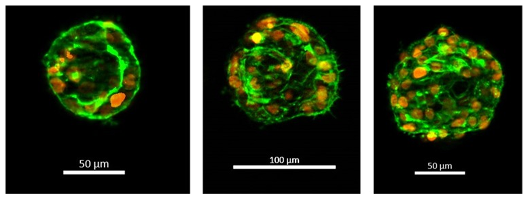 Follicular-like morphology of 3D thyroid microtissues at day 9