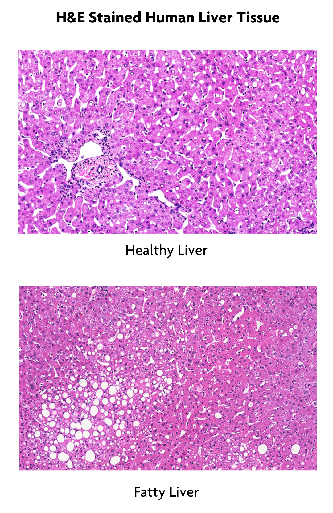 Healthy Liver