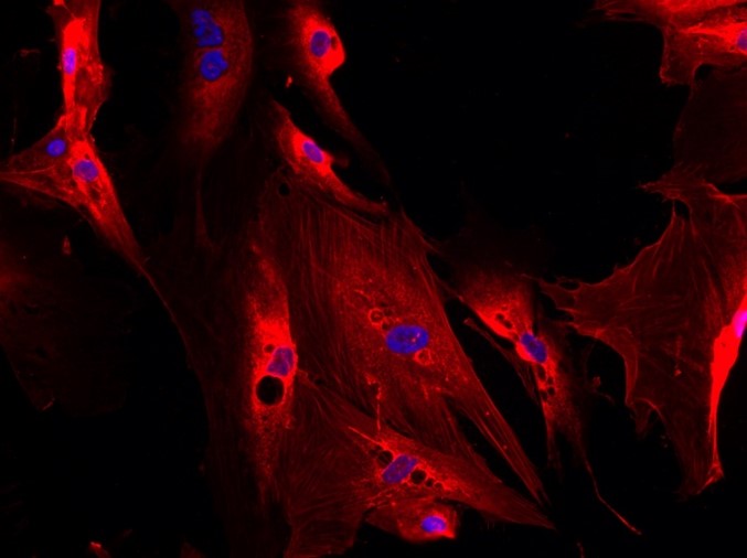 Immunofluorescence Staining for alpha-smooth muscle actin of human hepatic stellate cells