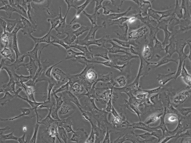 Human Hepatic Stellate Cells, Brightfield Optics