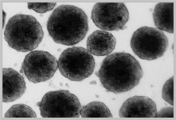 Spheroid formation of primary human hepatocytes