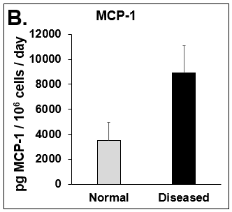Expression of pro-inflammatory cytokines and fibrotic markers. Levels of (A) IL-6, a pro-inflammatory cytokine, and (B) MCP-1, a pro-inflammatory chemokine, in Normal (grey bar) and Diseased (black bar) PHHs in the hTCS on day 14. The fibrotic markers of (C)  CK-18 and (D) TGF-β were measured in Normal (grey bar) and Diseased (black bar) PHHs on day 14. Error bars represent standard deviation (n ≥ 3 wells).