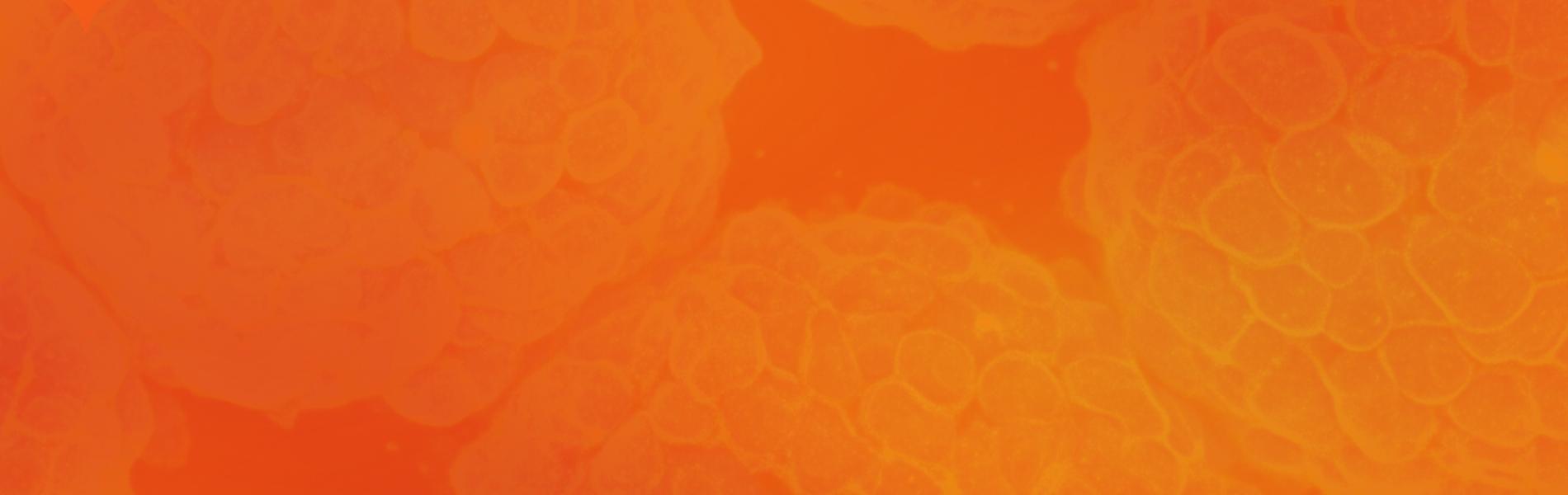 Orange background