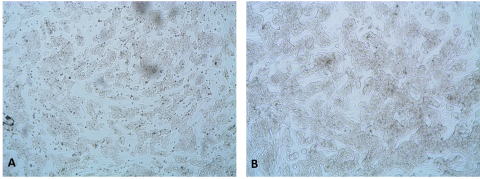 Figure 4. Brightfield Images of TruVivo + KCs with (A) and without (B) TGF-β1 Treatment. 