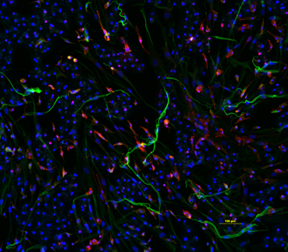 Figure 5. Immunostaining of TruVivo + KCs.