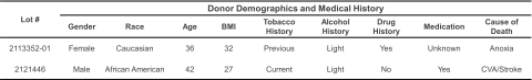 Table 1. Characteristics of PHH and KC donors.