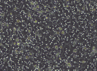 Brightfield image of adult primary human hepatocytes at day 4 of culture