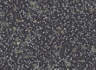 Hepatocytes Brightfield image of adult primary human hepatocytes at day 4 of culture