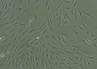 Protocol -  Primary Human Stellate Cells