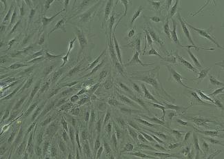 brightfield image of human hepatic stellate cells, passage zero, at 11 days post plating, 100X