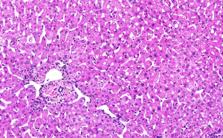 /formalin-fixed-paraffin-embedded