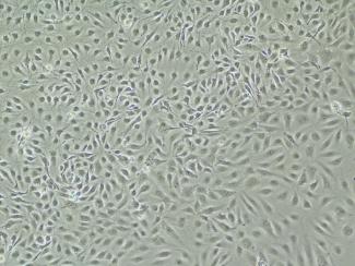 brightfield image of human liver-derived endothelial cells, passage zero, at 13 days post plating, 100X