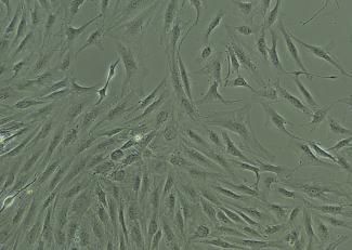 Protocol - Primary Human Stellate Cells