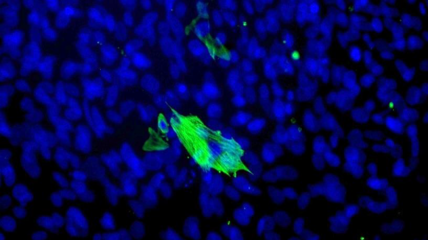 Beating cardiomyocytes derived from embryoid bodies stained for cardiac troponin