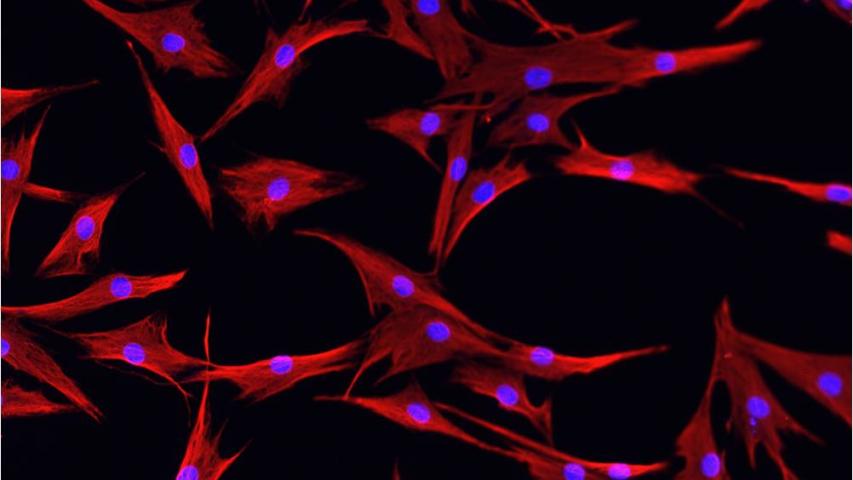 Primary Human Fibroblasts stained for vimentin