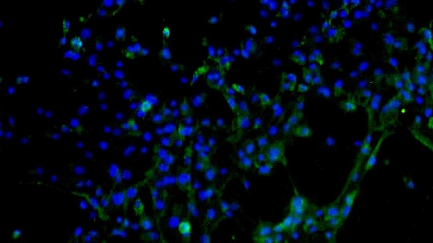 Human alveolar type II epithelial cells at passage 1 stained for ACE2